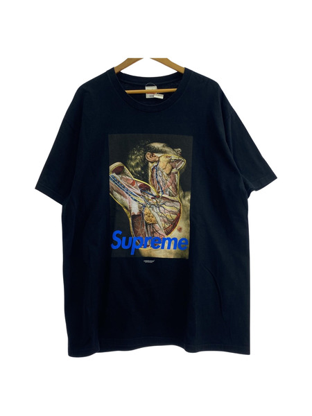 Supreme×UNDERCOVER 16AW Anatomy Tee Black XL 黒[値下]